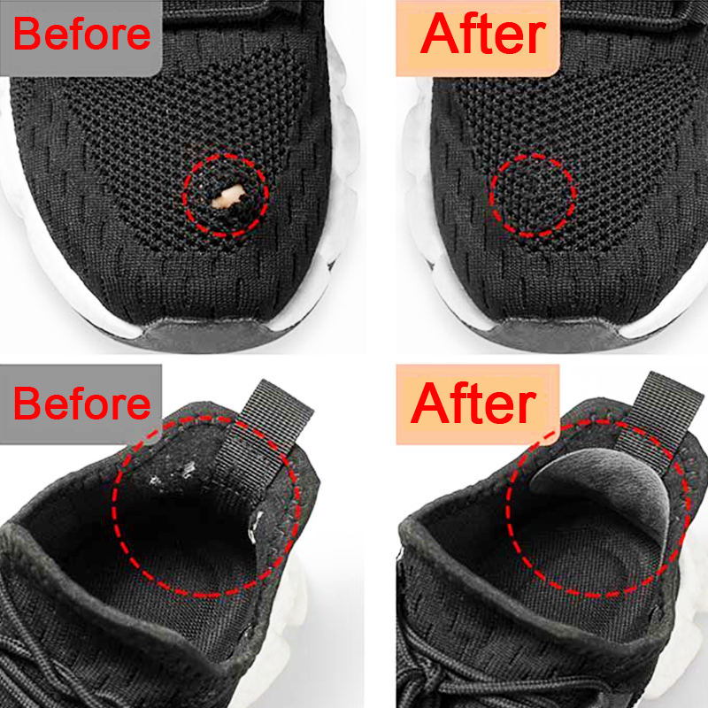 Sports Shoes Patches Vamp Repa - Sports Equipment Repair ulasan dan harga